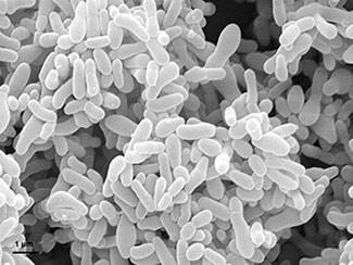 Scanning electron micrograph of Gardnerella vaginalis bacteria