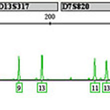 Cellular fingerprint: This electropherogram demonstrates the STR (short tandom repeat) technique NIST will use to identify human cell lines.