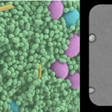 (LEFT) False-colored scanning electron micrograph of bacteria and yeast. (RIGHT) Time-lapse optical microscopy of W. anomolous in a single microwell.