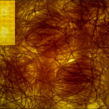Micrograph shows coiled fibers on yellow background with inset of lighter yellow square. 