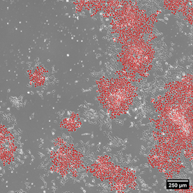 This figure shows a microscopic image of a field of cells, some of which are pseudocolored red to indicate that these cells remain pluripotent.