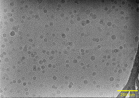 Cryogenic electron microscopy (cryo-EM) image of an LNP/RNA formulation